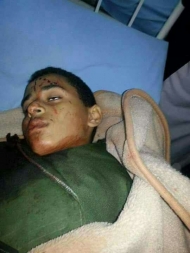 صورة.. من ضحايا تفجير القنبلة في مدرسة الطهيف في حي الأصبحي بصنعاء