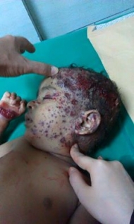صورة لاحد اطفال عدن الذين قتلوا في قصف المليشيات
