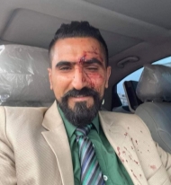 بعد يوم من النطق بالحكم.. محامي "الأغبري" يتعرض لاعتداء بالطعن لحظة مغادرته محكمة جنوب غرب الأمانة