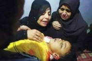 طفلة في المعلا عدن تم قنصها من قبل مليشيات الحوثي