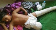 تعز..قتلى وجرحى مدننين بينهم طفل ونساء بانفجار لغم بسيارة للنازحين في جبل حبشي