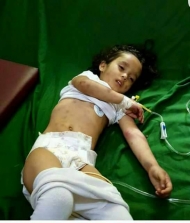 طفلة اصيبت جراء قصف المليشيا احياء تعز